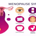 menopause symptoms