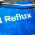 Betaine HCL for Acid Reflux