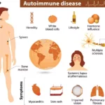 Autoimmune Diseases: The Little-Known Key To Reversing It