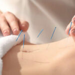 Using Chinese Medicine to Treat PCOS