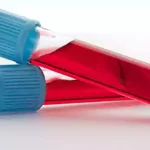 Lab tests intermittent fasting